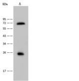 USAG1 / SOSTDC1 Antibody - Anti-SOSTDC1 rabbit polyclonal antibody at 1:500 dilution. Lane A: Mouse liver tissue lysate. Lysates/proteins at 30 ug per lane. Secondary: Goat Anti-Rabbit IgG (H+L)/HRP at 1/10000 dilution. Developed using the ECL technique. Performed under reducing conditions. Predicted band size: 23 kDa. Observed band size: 25 kDa.
