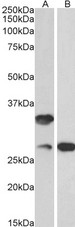 USB1 Antibody - Goat Anti-C16orf57 (aa154-167) Antibody (0.1µg/ml) staining of Mouse (A) and Rat (B) Skin lysates (35µg protein in RIPA buffer). Primary incubation was 1 hour. Detected by chemiluminescencence.