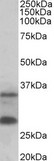 USB1 Antibody - C16orf57 antibody (0.3 ug/ml) staining of Human Skin lysate (35 ug protein in RIPA buffer). Primary incubation was 1 hour. Detected by chemiluminescence.