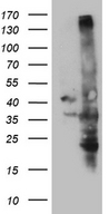 USB1 Antibody - HEK293T cells were transfected with the pCMV6-ENTRY control. (Left lane) or pCMV6-ENTRY C16orf57. (Right lane) cDNA for 48 hrs and lysed