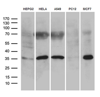 USB1 Antibody - Western blot analysis of extracts. (35ug) from 5 different cell lines by using anti-C16orf57 monoclonal antibody. (1:500)