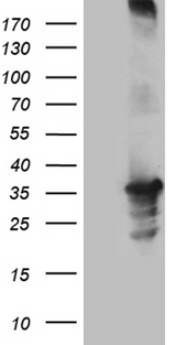 USB1 Antibody - HEK293T cells were transfected with the pCMV6-ENTRY control. (Left lane) or pCMV6-ENTRY C16orf57. (Right lane) cDNA for 48 hrs and lysed. Equivalent amounts of cell lysates. (5 ug per lane) were separated by SDS-PAGE and immunoblotted with anti-C16orf57. (1:2000)