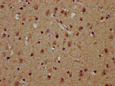 USB1 Antibody - Immunohistochemistry Dilution at 1:100 and staining in paraffin-embedded human brain tissue performed on a Leica BondTM system. After dewaxing and hydration, antigen retrieval was mediated by high pressure in a citrate buffer (pH 6.0). Section was blocked with 10% normal Goat serum 30min at RT. Then primary antibody (1% BSA) was incubated at 4°C overnight. The primary is detected by a biotinylated Secondary antibody and visualized using an HRP conjugated SP system.