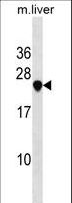 USE1 / p31 Antibody - USE1 Antibody western blot of mouse liver tissue lysates (35 ug/lane). The USE1 antibody detected the USE1 protein (arrow).