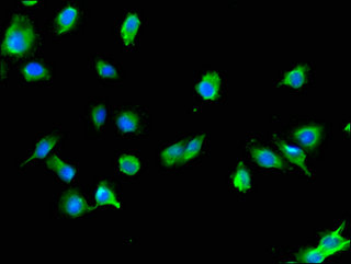 USE1 / p31 Antibody - Immunofluorescent analysis of U251 cells using USE1 Antibody at a dilution of 1:100 and Alexa Fluor 488-congugated AffiniPure Goat Anti-Rabbit IgG(H+L)