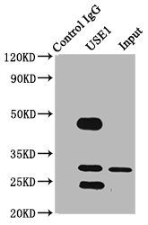 USE1 / p31 Antibody - Immunoprecipitating USE1 in PC-3 whole cell lysate Lane 1: Rabbit control IgG (1µg) instead of USE1 Antibody in PC-3 whole cell lysate.For western blotting, a HRP-conjugated Protein G antibody was used as the secondary antibody (1/2000) Lane 2: USE1 Antibody (6µg) + PC-3 whole cell lysate (500µg) Lane 3: PC-3 whole cell lysate (10µg)
