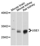 USE1 / p31 Antibody - Western blot analysis of extracts of various cell lines, using USE1 antibody at 1:3000 dilution. The secondary antibody used was an HRP Goat Anti-Rabbit IgG (H+L) at 1:10000 dilution. Lysates were loaded 25ug per lane and 3% nonfat dry milk in TBST was used for blocking. An ECL Kit was used for detection and the exposure time was 30s.
