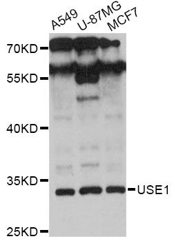 USE1 / p31 Antibody - Western blot analysis of extracts of various cell lines, using USE1 antibody at 1:3000 dilution. The secondary antibody used was an HRP Goat Anti-Rabbit IgG (H+L) at 1:10000 dilution. Lysates were loaded 25ug per lane and 3% nonfat dry milk in TBST was used for blocking. An ECL Kit was used for detection and the exposure time was 30s.