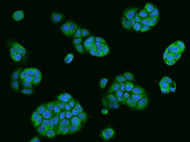 USE1 / p31 Antibody - Immunofluorescence staining of USE1 in MCF7 cells. Cells were fixed with 4% PFA, permeabilzed with 0.1% Triton X-100 in PBS, blocked with 10% serum, and incubated with rabbit anti-Human USE1 polyclonal antibody (dilution ratio 1:200) at 4°C overnight. Then cells were stained with the Alexa Fluor 488-conjugated Goat Anti-rabbit IgG secondary antibody (green) and counterstained with DAPI (blue). Positive staining was localized to Cytoplasm.