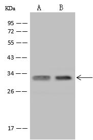 USE1 / p31 Antibody - Anti-USE1 rabbit polyclonal antibody at 1:500 dilution. Lane A: Jurkat Whole Cell Lysate. Lane B: U-251 MG Whole Cell Lysate. Lysates/proteins at 30 ug per lane. Secondary: Goat Anti-Rabbit IgG (H+L)/HRP at 1/10000 dilution. Developed using the ECL technique. Performed under reducing conditions. Predicted band size: 29 kDa. Observed band size: 33 kDa.