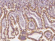 USE1 / p31 Antibody - Immunochemical staining of human USE1 in human duodenum with rabbit polyclonal antibody at 1:100 dilution, formalin-fixed paraffin embedded sections.