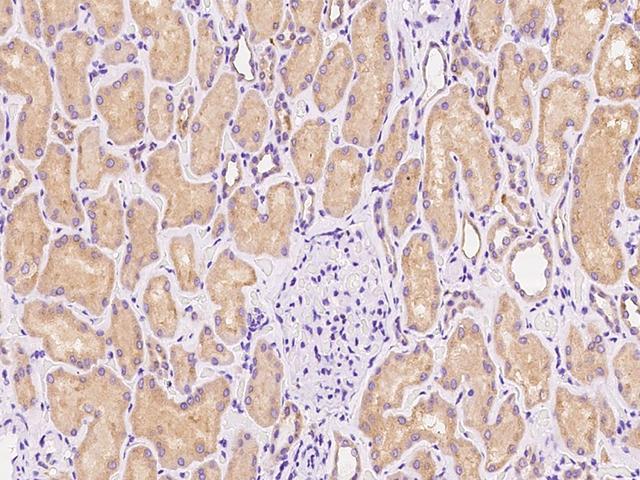 USE1 / p31 Antibody - Immunochemical staining of human USE1 in human kidney with rabbit polyclonal antibody at 1:100 dilution, formalin-fixed paraffin embedded sections.