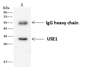 USE1 / p31 Antibody - USE1 was immunoprecipitated using: Lane A: 0.5 mg Jurkat Whole Cell Lysate. 4 uL anti-USE1 rabbit polyclonal antibody and 60 ug of Immunomagnetic beads Protein A/G. Primary antibody: Anti-USE1 rabbit polyclonal antibody, at 1:100 dilution. Secondary antibody: Goat Anti-Rabbit IgG (H+L)/HRP at 1/10000 dilution. Developed using the ECL technique. Performed under reducing conditions. Predicted band size: 29 kDa. Observed band size: 29 kDa.