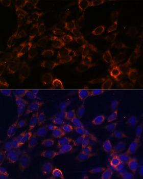 USE1 / p31 Antibody - Immunofluorescence analysis of NIH/3T3 cells using USE1 Polyclonal Antibody at dilution of 1:100 (40x lens).Blue: DAPI for nuclear staining.