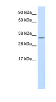USE1 / p31 Antibody - USE1 antibody ARP37352_P050-NP_080193-2010315L10RIK Antibody Western blot of SP2/0 cell lysate.  This image was taken for the unconjugated form of this product. Other forms have not been tested.