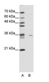 USE1 / p31 Antibody - A: Marker, B: Jurkat Cell Lysate.  This image was taken for the unconjugated form of this product. Other forms have not been tested.