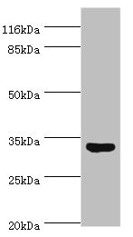 USF1 / USF Antibody - Western blot All lanes: Upstream stimulatory factor 1 antibody at 2µg/ml + HepG2 whole cell lysate Secondary Goat polyclonal to rabbit IgG at 1/10000 dilution Predicted band size: 34, 28 kDa Observed band size: 34 kDa