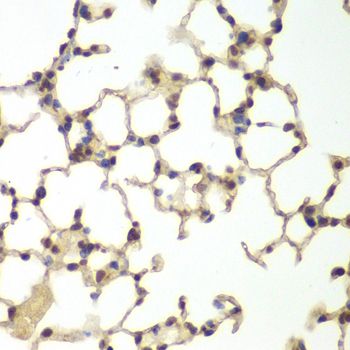 USF1 / USF Antibody - Immunohistochemistry of paraffin-embedded mouse lung using USF1 antibody at dilution of 1:200 (40x lens).
