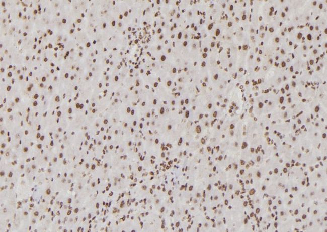 USF1 / USF Antibody - 1:100 staining rat liver tissue by IHC-P. The sample was formaldehyde fixed and a heat mediated antigen retrieval step in citrate buffer was performed. The sample was then blocked and incubated with the antibody for 1.5 hours at 22°C. An HRP conjugated goat anti-rabbit antibody was used as the secondary.
