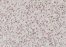 USF1 / USF Antibody - 1:100 staining rat liver tissue by IHC-P. The sample was formaldehyde fixed and a heat mediated antigen retrieval step in citrate buffer was performed. The sample was then blocked and incubated with the antibody for 1.5 hours at 22°C. An HRP conjugated goat anti-rabbit antibody was used as the secondary.