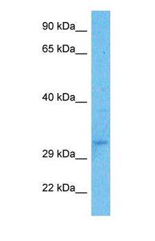 USF1 / USF Antibody - Western blot of USF1 Antibody with human Fetal Kidney lysate.  This image was taken for the unconjugated form of this product. Other forms have not been tested.