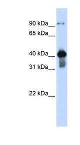 USF2 Antibody - USF2 antibody Western blot of Transfected 293T cell lysate. This image was taken for the unconjugated form of this product. Other forms have not been tested.