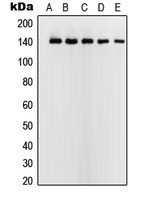 USF2 Antibody - Western blot analysis of USF2 expression in HeLa (A); Jurkat (B); K562 (C); A431 (D); NIH3T3 (E) whole cell lysates.