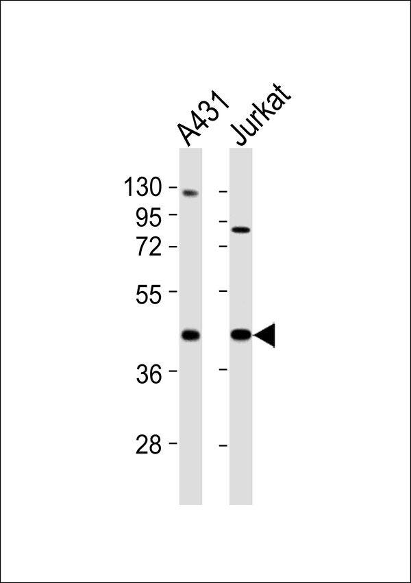 USF2 Antibody - All lanes : Anti-USF2 Antibody at 1:1000 dilution Lane 1: A431 whole cell lysates Lane 2: Jurkat whole cell lysates Lysates/proteins at 20 ug per lane. Secondary Goat Anti-Rabbit IgG, (H+L),Peroxidase conjugated at 1/10000 dilution Predicted band size : 37 kDa Blocking/Dilution buffer: 5% NFDM/TBST.