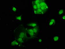 USF2 Antibody - Immunofluorescence staining of MCF-7 cells at a dilution of 1:100, counter-stained with DAPI. The cells were fixed in 4% formaldehyde, permeabilized using 0.2% Triton X-100 and blocked in 10% normal Goat Serum. The cells were then incubated with the antibody overnight at 4 °C.The secondary antibody was Alexa Fluor 488-congugated AffiniPure Goat Anti-Rabbit IgG (H+L) .