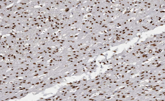 USF2 Antibody - 1:100 staining human Smooth muscle tissue by IHC-P. The tissue was formaldehyde fixed and a heat mediated antigen retrieval step in citrate buffer was performed. The tissue was then blocked and incubated with the antibody for 1.5 hours at 22°C. An HRP conjugated goat anti-rabbit antibody was used as the secondary.