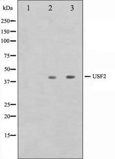 USF2 Antibody - Western blot analysis on HeLa and HepG2 cell lysates using USF2 antibody. The lane on the left is treated with the antigen-specific peptide.