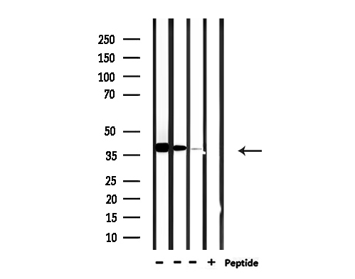 USF2 Antibody - Western blot analysis of extracts of 293 cells and HeLa and rat brain tissue using USF2 antibody.