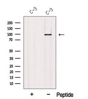 USHBP1 Antibody - Western blot analysis of extracts of C-3 cells using MCC antibody. The lane on the left was treated with blocking peptide.