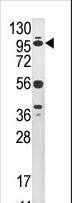 USP1 Antibody - Western blot of anti-USP1 antibody in HepG2 cell line lysate (35 ug/lane). USP1(arrow) was detected using the purified Pab