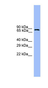 USP1 Antibody - USP1 antibody Western blot of Fetal Brain lysate. This image was taken for the unconjugated form of this product. Other forms have not been tested.