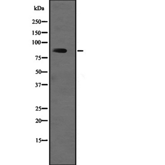 USP1 Antibody - Western blot analysis of USP1 expression in human fetal brain lysate. The lane on the left is treated with the antigen-specific peptide.