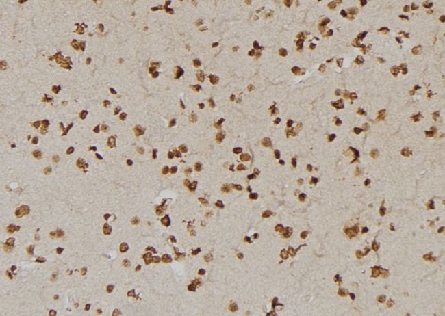 USP1 Antibody - 1:100 staining human brain tissue by IHC-P. The sample was formaldehyde fixed and a heat mediated antigen retrieval step in citrate buffer was performed. The sample was then blocked and incubated with the antibody for 1.5 hours at 22°C. An HRP conjugated goat anti-rabbit antibody was used as the secondary.