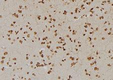 USP1 Antibody - 1:100 staining human brain tissue by IHC-P. The sample was formaldehyde fixed and a heat mediated antigen retrieval step in citrate buffer was performed. The sample was then blocked and incubated with the antibody for 1.5 hours at 22°C. An HRP conjugated goat anti-rabbit antibody was used as the secondary.