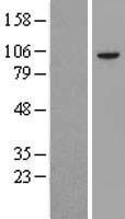 USP1 Protein - Western validation with an anti-DDK antibody * L: Control HEK293 lysate R: Over-expression lysate