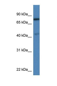 USP10 Antibody - USP10 antibody Western blot of Rat Lung lysate. Antibody concentration 1 ug/ml.  This image was taken for the unconjugated form of this product. Other forms have not been tested.