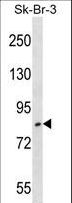 USP10 Antibody - USP10 Antibody western blot of SK-BR-3 cell line lysates (35 ug/lane). The USP10 antibody detected the USP10 protein (arrow).