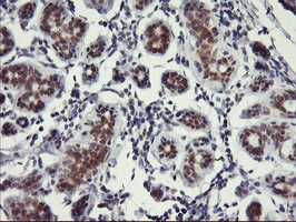 USP10 Antibody - IHC of paraffin-embedded Human breast tissue using anti-USP10 mouse monoclonal antibody.