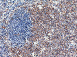 USP10 Antibody - IHC of paraffin-embedded Human tonsil using anti-USP10 mouse monoclonal antibody.