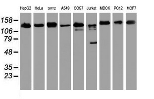 USP10 Antibody - Western blot of extracts (35 ug) from 9 different cell lines by using anti-USP10 monoclonal antibody.