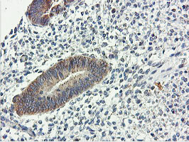 USP10 Antibody - IHC of paraffin-embedded Human endometrium tissue using anti-USP10 mouse monoclonal antibody.