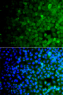 USP10 Antibody - Immunofluorescence analysis of A549 cells.