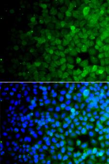USP10 Antibody - Immunofluorescence analysis of A549 cells.