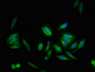 USP10 Antibody - Immunofluorescent analysis of Hela cells at a dilution of 1:100 and Alexa Fluor 488-congugated AffiniPure Goat Anti-Rabbit IgG(H+L)