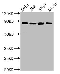 USP10 Antibody - Positive Western Blot detected in Hela whole cell lysate, 293 whole cell lysate, A549 whole cell lysate, Rat liver tissue. All lanes: USP10 antibody at 3 µg/ml Secondary Goat polyclonal to rabbit IgG at 1/50000 dilution. Predicted band size: 88, 93 KDa. Observed band size: 88 KDa