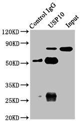 USP10 Antibody - Immunoprecipitating USP10 in A549 whole cell lysate Lane 1: Rabbit control IgG instead of USP10 Antibody in A549 whole cell lysate.For western blotting, a HRP-conjugated Protein G antibody was used as the secondary antibody (1/2000) Lane 2: USP10 Antibody (8µg) + A549 whole cell lysate (500µg) Lane 3: A549 whole cell lysate (10µg)